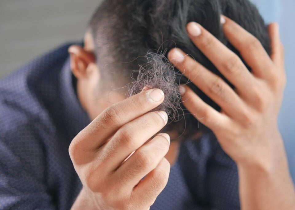 Does lack of sleep cause hair loss?